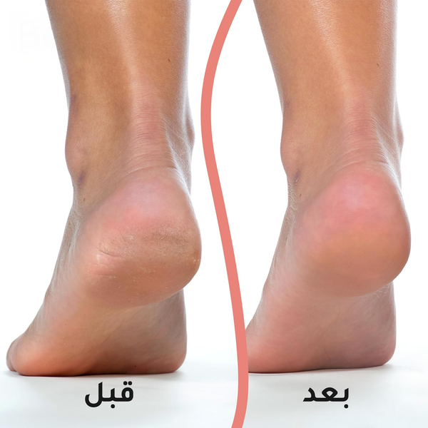 جهاز العناية وتقشير الجلد الميت