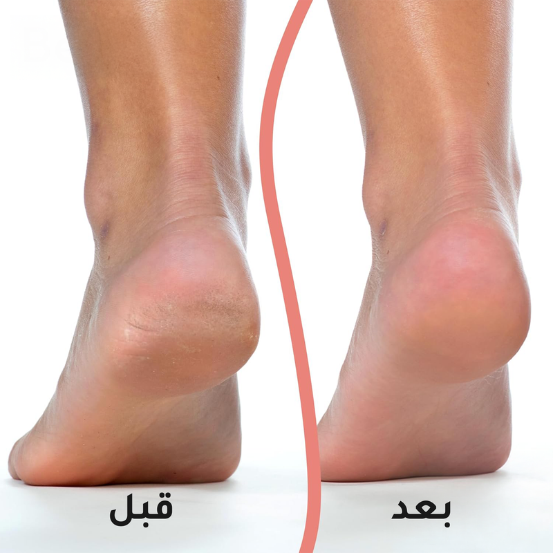 جهاز العناية وتقشير الجلد الميت